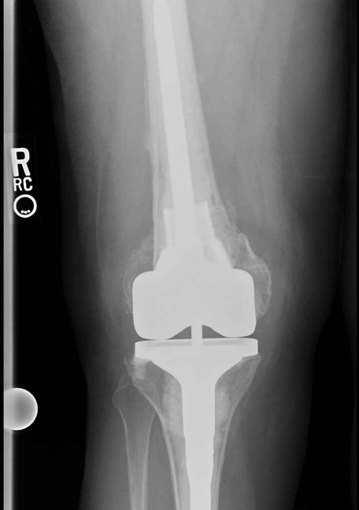 Carol Kramer in the photo 2