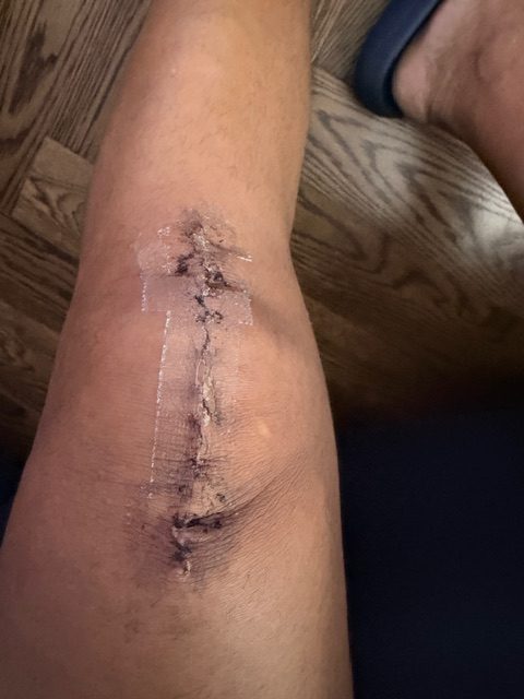 Kenneth Morales in the photo 2