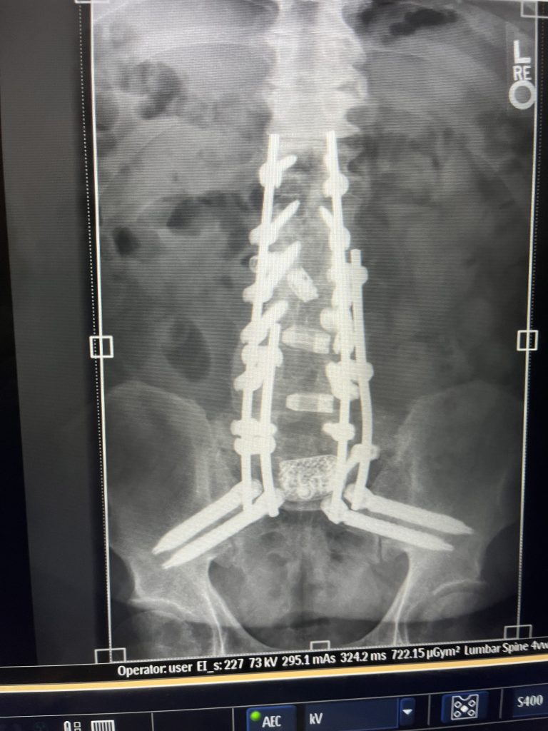 Merrill White in the photo 3