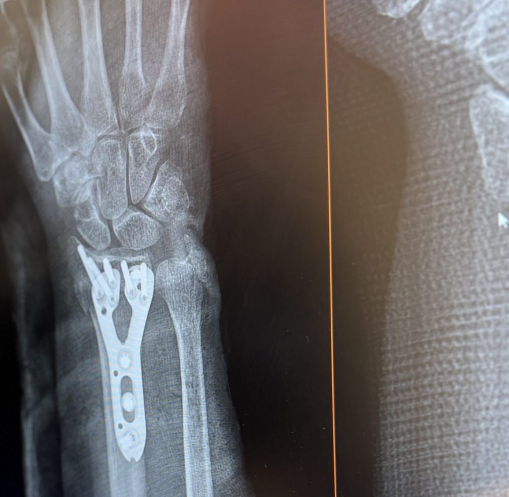 Heather Duddy in the photo 1