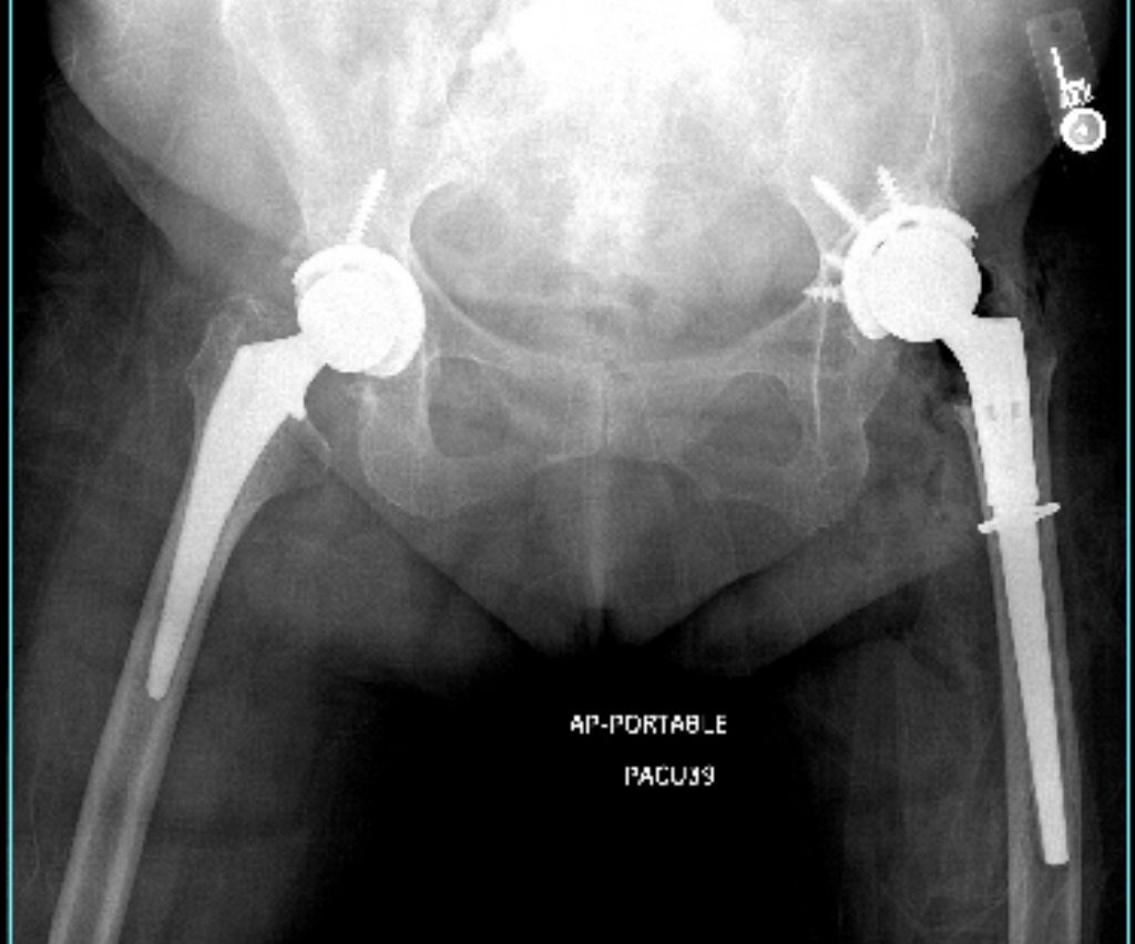 Kathy Friedman in the photo 1