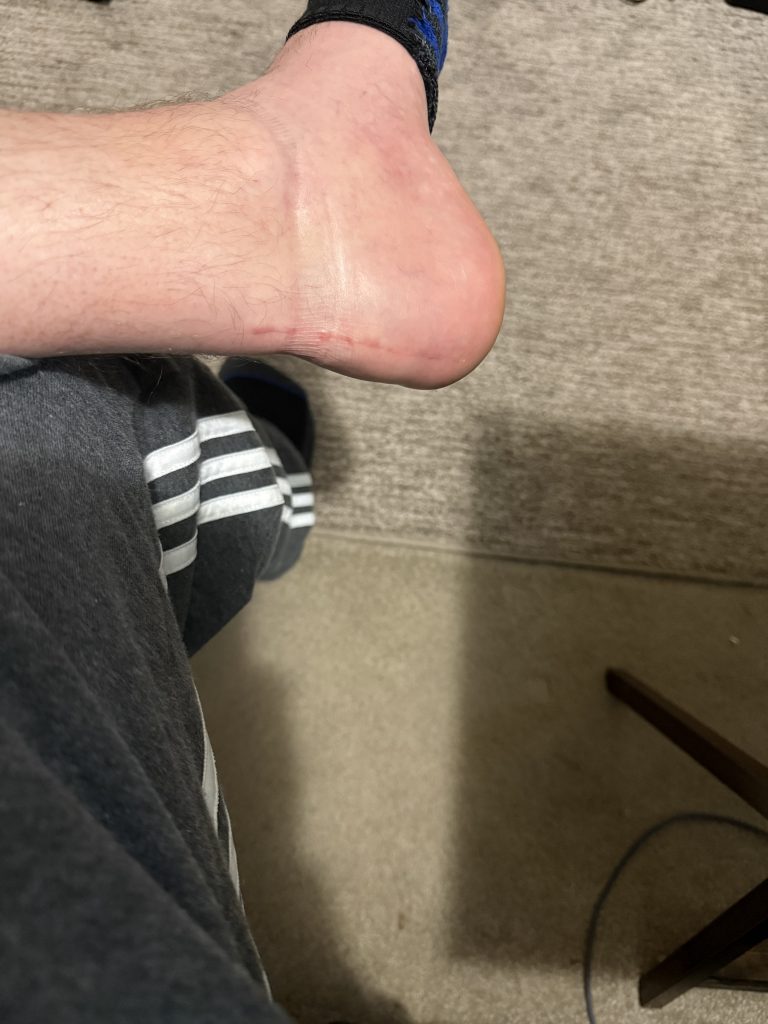 Alexander Schanck in the photo 1