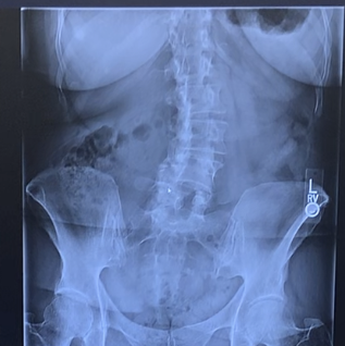 Gail Morton in the photo 1