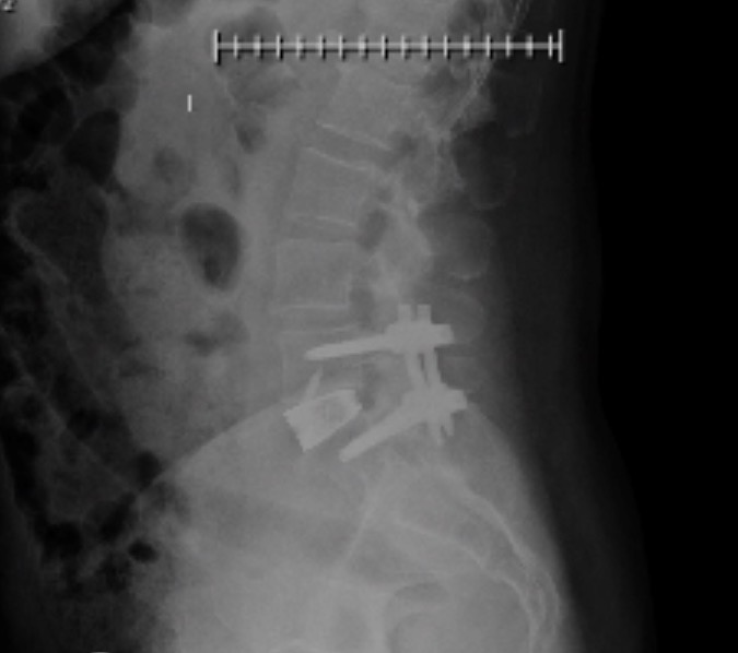 Nancy Kohlhoff in the photo 2